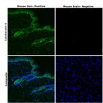 Cytokeratin 5 Antibody in Immunohistochemistry (Paraffin) (IHC (P))