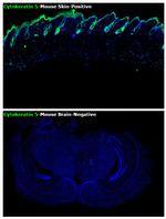 Cytokeratin 5 Antibody