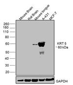 Cytokeratin 5 Antibody in Western Blot (WB)