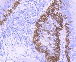 Cytokeratin 5 Antibody in Immunohistochemistry (Paraffin) (IHC (P))