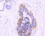 Cytokeratin 5 Antibody in Immunohistochemistry (Paraffin) (IHC (P))