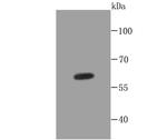 Cytokeratin 5 Antibody in Western Blot (WB)