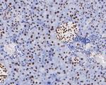 HDAC1 Antibody in Immunohistochemistry (Paraffin) (IHC (P))