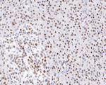 HDAC1 Antibody in Immunohistochemistry (Paraffin) (IHC (P))