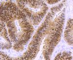 CDX2 Antibody in Immunohistochemistry (Paraffin) (IHC (P))