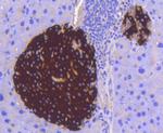 STAT3 Antibody in Immunohistochemistry (Paraffin) (IHC (P))