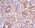 STAT3 Antibody in Immunohistochemistry (Paraffin) (IHC (P))