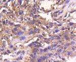 STAT3 Antibody in Immunohistochemistry (Paraffin) (IHC (P))