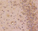 STAT3 Antibody in Immunohistochemistry (Paraffin) (IHC (P))