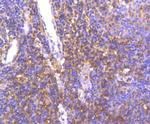 c-Met Antibody in Immunohistochemistry (Paraffin) (IHC (P))