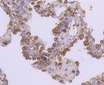 c-Met Antibody in Immunohistochemistry (Paraffin) (IHC (P))