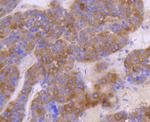 c-Met Antibody in Immunohistochemistry (Paraffin) (IHC (P))