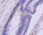 c-Met Antibody in Immunohistochemistry (Paraffin) (IHC (P))