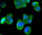 MSI1 Antibody in Immunocytochemistry (ICC/IF)