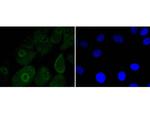 MSI1 Antibody in Immunocytochemistry (ICC/IF)