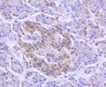 MSI1 Antibody in Immunohistochemistry (Paraffin) (IHC (P))