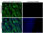 Synaptophysin Antibody in Immunohistochemistry (Paraffin) (IHC (P))