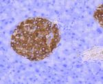 Synaptophysin Antibody in Immunohistochemistry (Paraffin) (IHC (P))