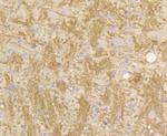 STAT3 Antibody in Immunohistochemistry (Paraffin) (IHC (P))