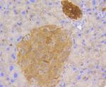 STAT3 Antibody in Immunohistochemistry (Paraffin) (IHC (P))