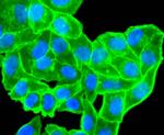 Alpha-Smooth Muscle Actin Antibody in Immunocytochemistry (ICC/IF)