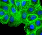 Alpha-Smooth Muscle Actin Antibody in Immunocytochemistry (ICC/IF)