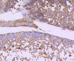 GSK3B Antibody in Immunohistochemistry (Paraffin) (IHC (P))