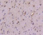 VPS34 Antibody in Immunohistochemistry (Paraffin) (IHC (P))