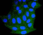 Bim Antibody in Immunocytochemistry (ICC/IF)