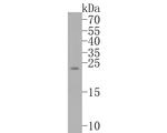 Bim Antibody in Western Blot (WB)