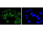 PARP1 Antibody in Immunocytochemistry (ICC/IF)