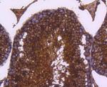 LDHB Antibody in Immunohistochemistry (Paraffin) (IHC (P))