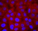 PI3K p85 alpha Antibody in Immunocytochemistry (ICC/IF)