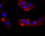 PI3K p85 alpha Antibody in Immunocytochemistry (ICC/IF)