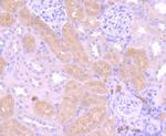 PI3K p85 alpha Antibody in Immunohistochemistry (Paraffin) (IHC (P))