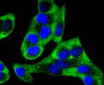 YBX1 Antibody in Immunocytochemistry (ICC/IF)