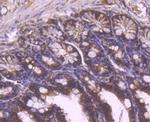 YBX1 Antibody in Immunohistochemistry (Paraffin) (IHC (P))