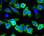 Stathmin 1 Antibody in Immunocytochemistry (ICC/IF)