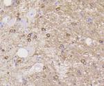 Stathmin 1 Antibody in Immunohistochemistry (Paraffin) (IHC (P))