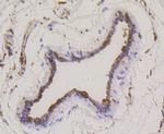 Stathmin 1 Antibody in Immunohistochemistry (Paraffin) (IHC (P))