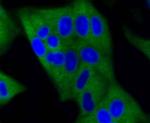 DNMT3A Antibody in Immunocytochemistry (ICC/IF)