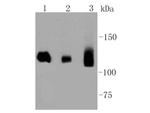 DNMT3A Antibody in Western Blot (WB)