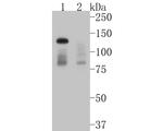 DNMT3A Antibody in Western Blot (WB)