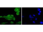 Phospho-AKT1 (Ser124) Antibody in Immunocytochemistry (ICC/IF)