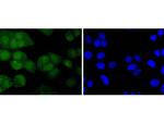 Phospho-AKT1 (Ser124) Antibody in Immunocytochemistry (ICC/IF)