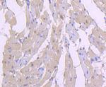 Phospho-AKT1 (Ser124) Antibody in Immunohistochemistry (Paraffin) (IHC (P))