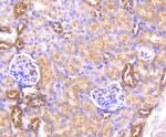 AKT1 Antibody in Immunohistochemistry (Paraffin) (IHC (P))