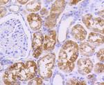 AKT Pan Antibody in Immunohistochemistry (Paraffin) (IHC (P))