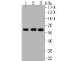 AKT Pan Antibody in Western Blot (WB)