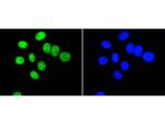 PIM1 Antibody in Immunocytochemistry (ICC/IF)